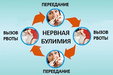 Лечение булимии в Грязовце